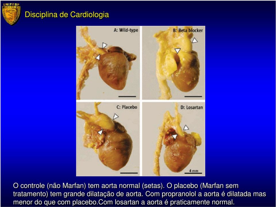 de aorta.