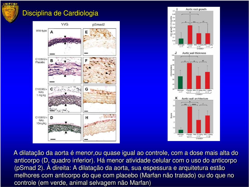 À direita: A dilatação da aorta, sua espessura e arquitetura estão melhores com anticorpo