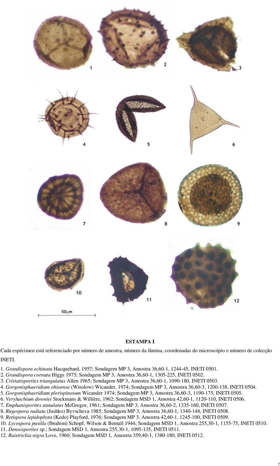4. Gorgonisphaeridium ohioense (Winslow) Wicander, 1974; Sondagem MP 3, Amostra 36,60-3, 1200-138, INETI 0504. 5.