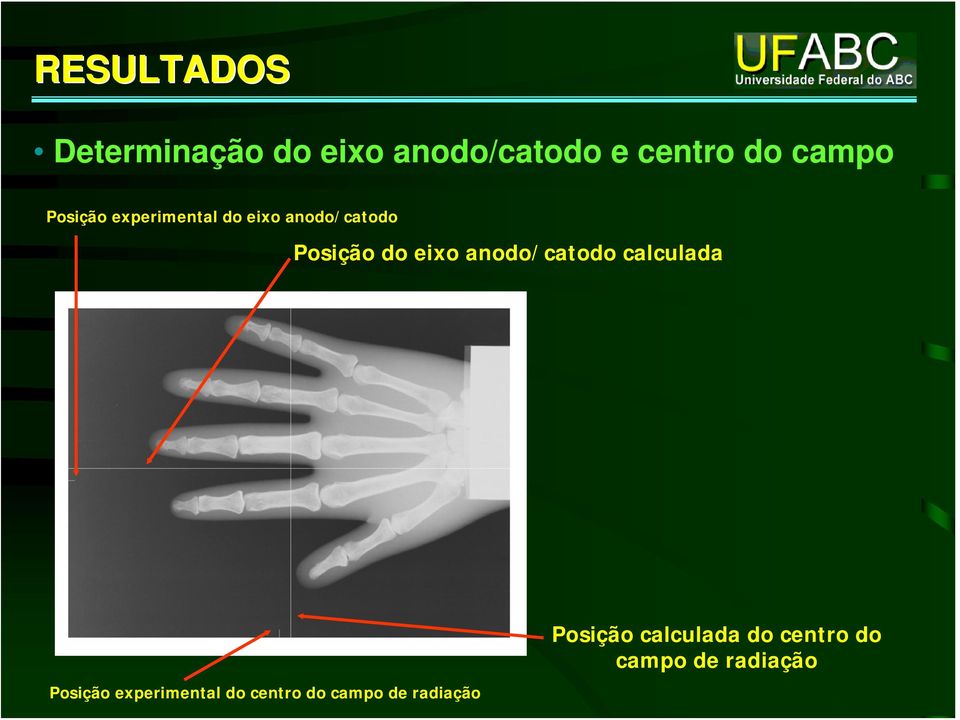 exo aodo/catodo calculada Posção expermetal do cetro do