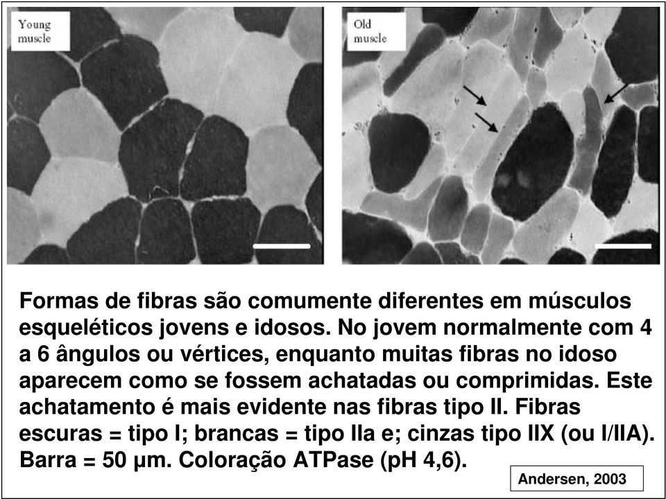 fossem achatadas ou comprimidas. Este achatamento é mais evidente nas fibras tipo II.