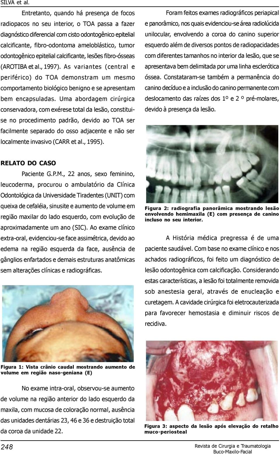 As variantes (central e periférico) do TOA demonstram um mesmo comportamento biológico benigno e se apresentam bem encapsuladas.