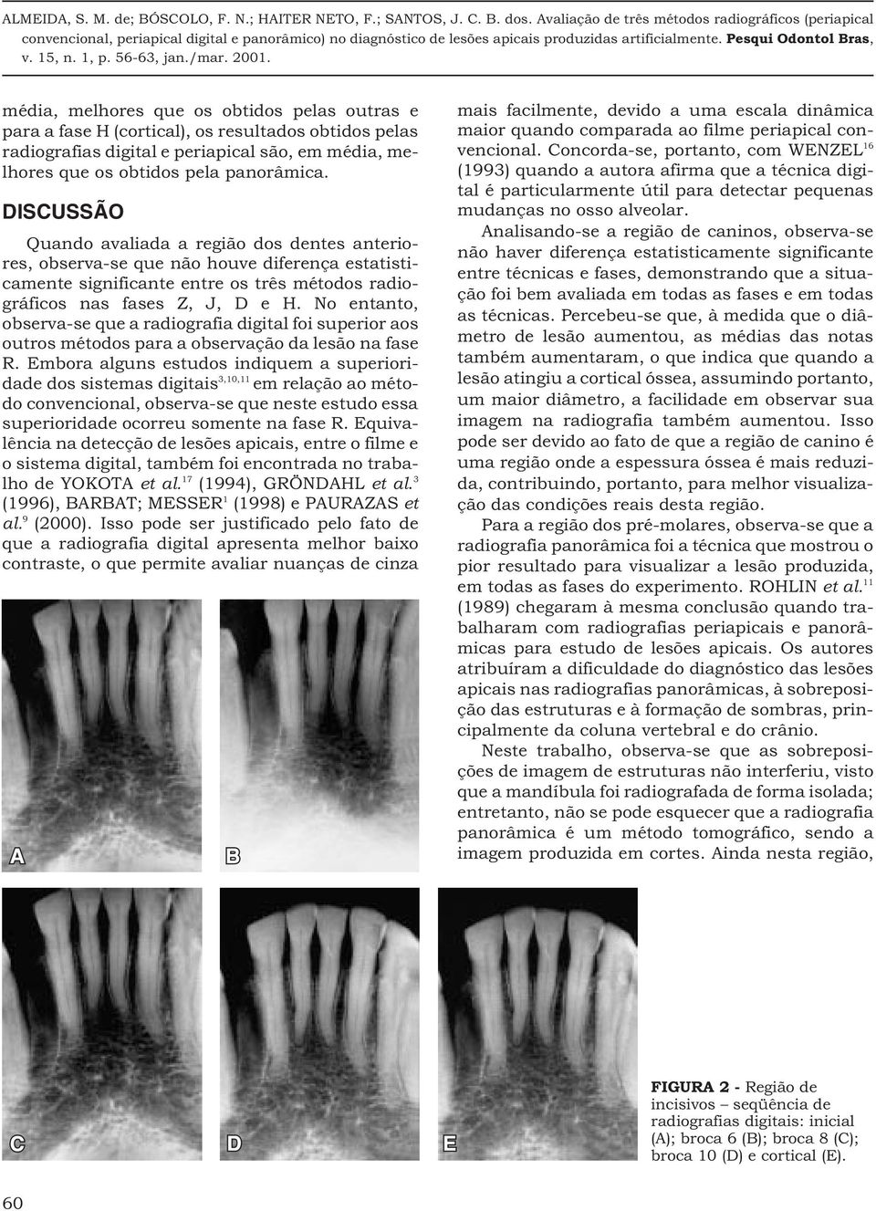 No entanto, observa-se que a radiografia digital foi superior aos outros métodos para a observação da lesão na fase R.