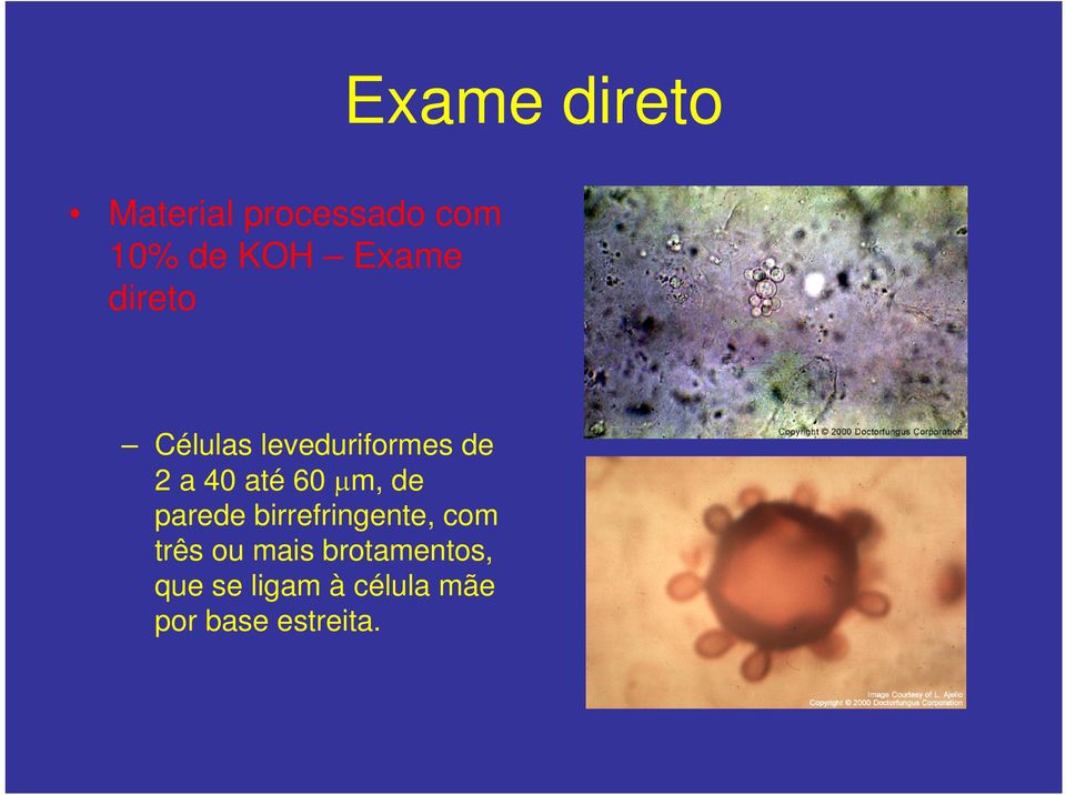 60 μm, de parede birrefringente, com três ou mais