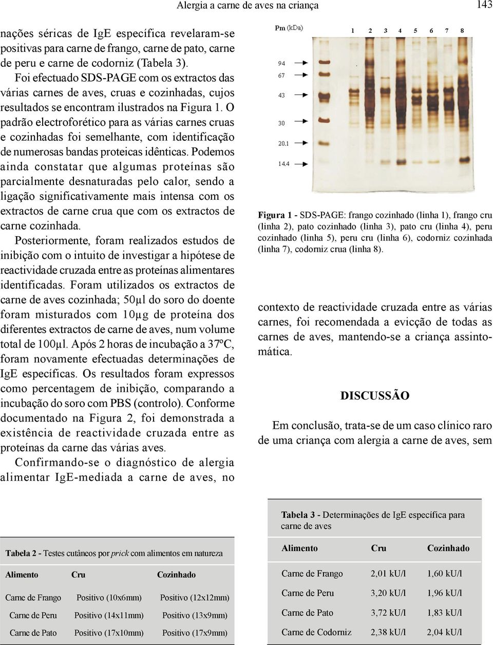 O padrão electroforético para as várias carnes cruas e cozinhadas foi semelhante, com identificação de numerosas bandas proteicas idênticas.