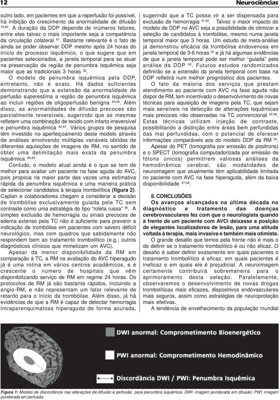 Bastante relevante é o fato de ainda se poder observar DDP mesmo após 24 horas do início do processo isquêmico, o que sugere que em pacientes selecionados, a janela temporal para se atuar na