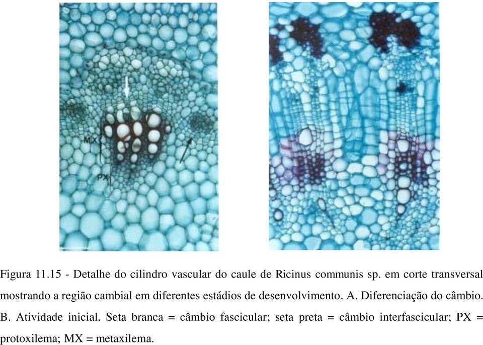 desenvolvimento. A. Diferenciação do câmbio. B. Atividade inicial.