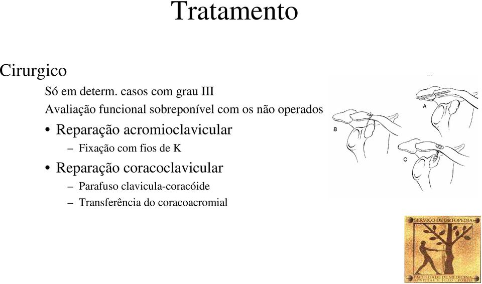 não operados Reparação acromioclavicular Fixação com fios de