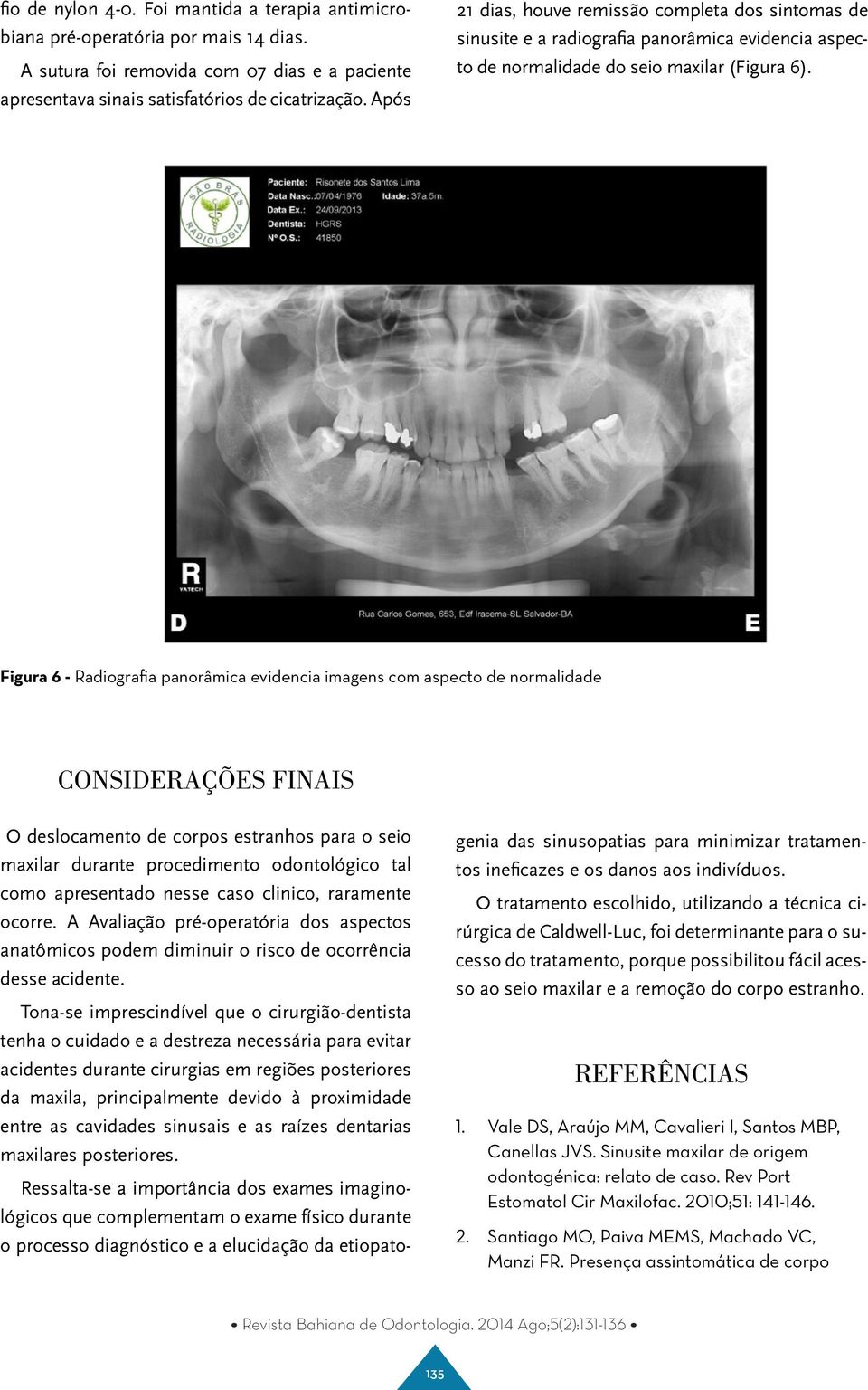 Figura 6 - Radiografia panorâmica evidencia imagens com aspecto de normalidade CONSIDERAÇÕES FINAIS O deslocamento de corpos estranhos para o seio maxilar durante procedimento odontológico tal como