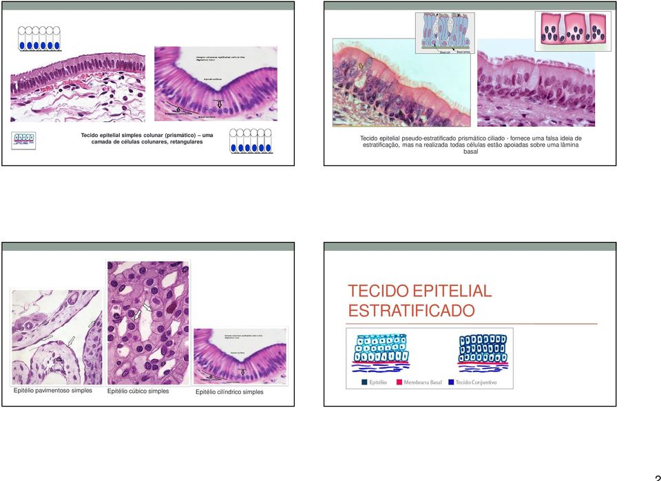 estratificação, mas na realizada todas células estão apoiadas sobre uma lâmina basal TECIDO