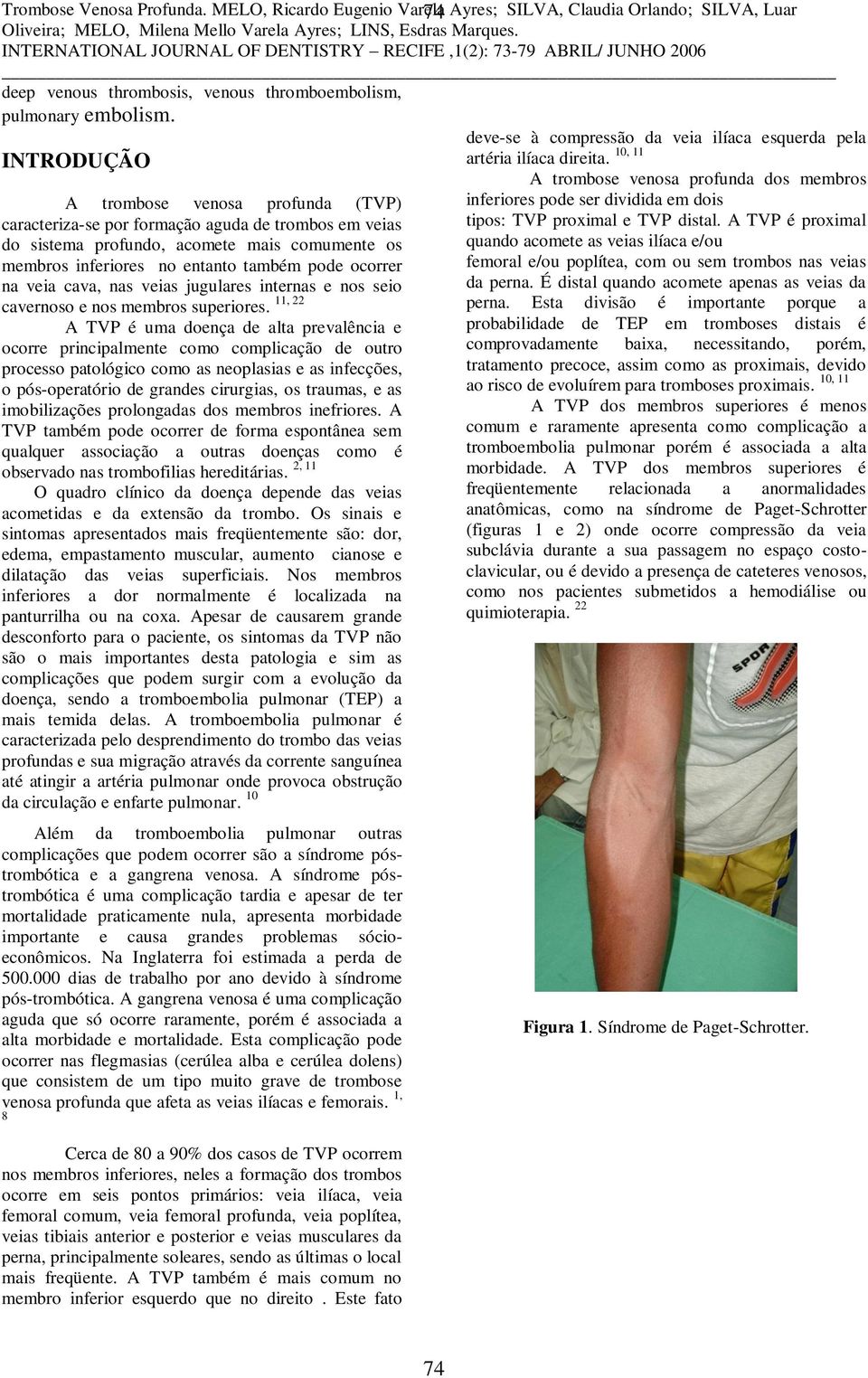 A TVP é proximal quando acomete as veias ilíaca e/ou femoral e/ou poplítea, com ou sem trombos nas veias da perna. É distal quando acomete apenas as veias da perna.