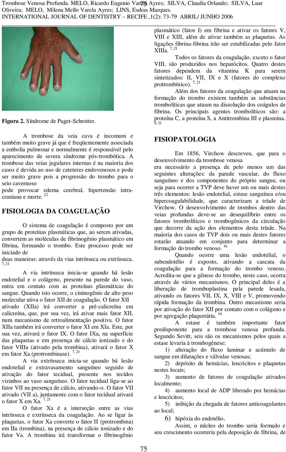 As ligações fibrina-fibrina irão ser estabilizadas pelo fator XIIIa. Todos os fatores da coagulação, exceto o fator VIII, são produzidos nos hepatócitos.