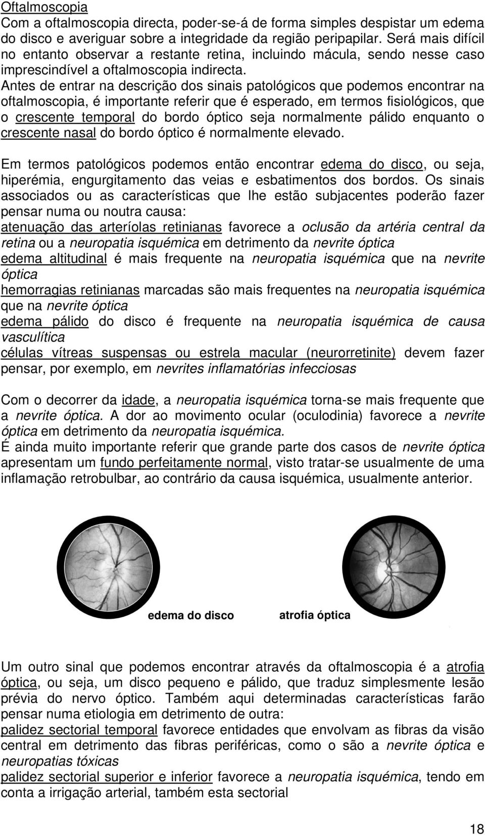 Antes de entrar na descrição dos sinais patológicos que podemos encontrar na oftalmoscopia, é importante referir que é esperado, em termos fisiológicos, que o crescente temporal do bordo óptico seja