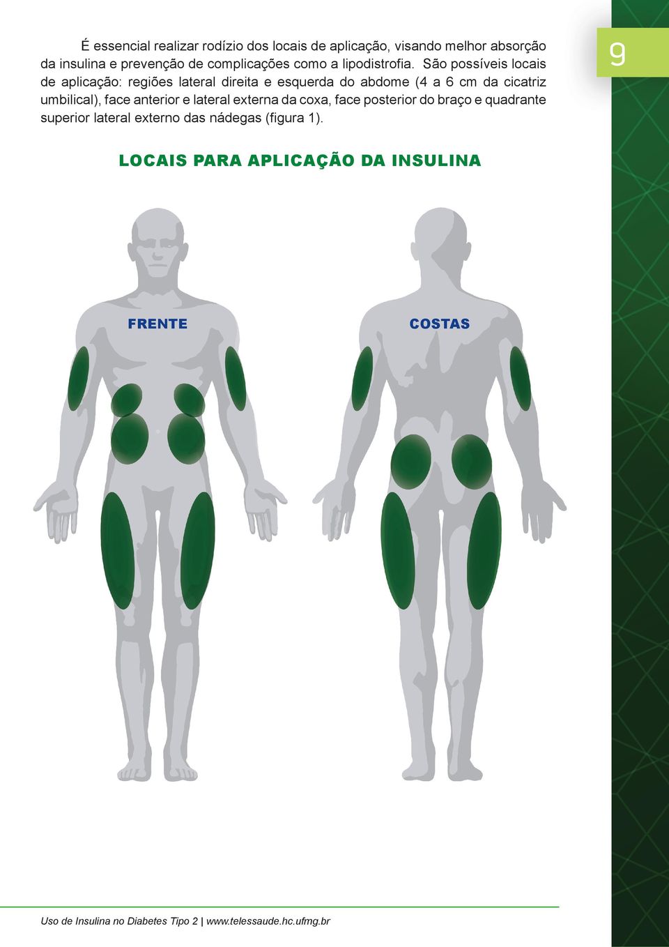 São possíveis locais de aplicação: regiões lateral direita e esquerda do abdome (4 a 6 cm da cicatriz