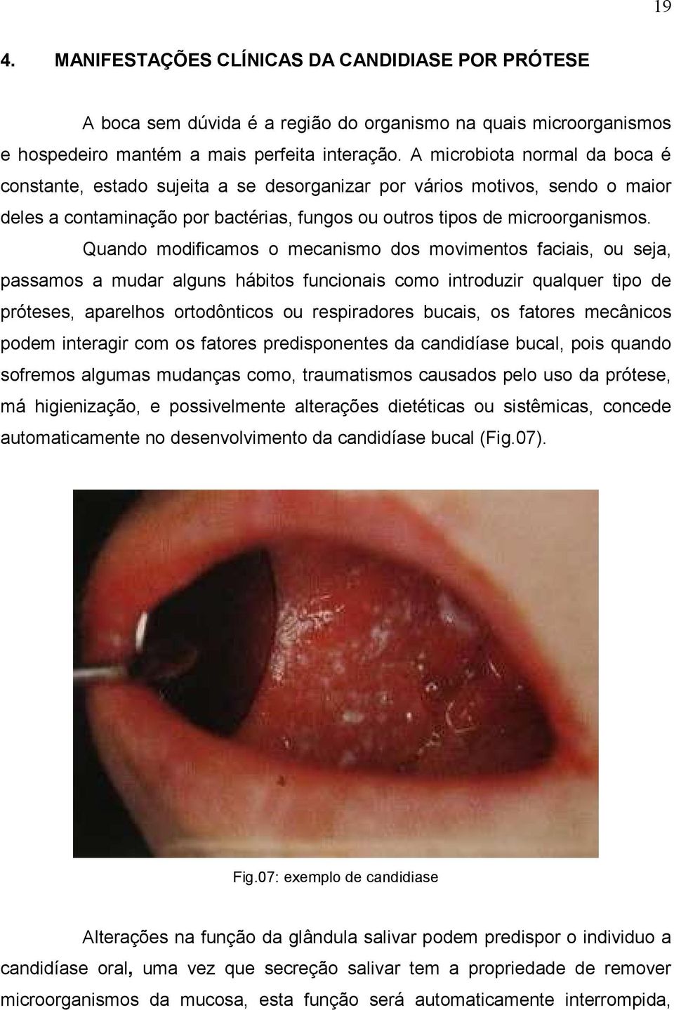 Quando modificamos o mecanismo dos movimentos faciais, ou seja, passamos a mudar alguns hábitos funcionais como introduzir qualquer tipo de próteses, aparelhos ortodônticos ou respiradores bucais, os