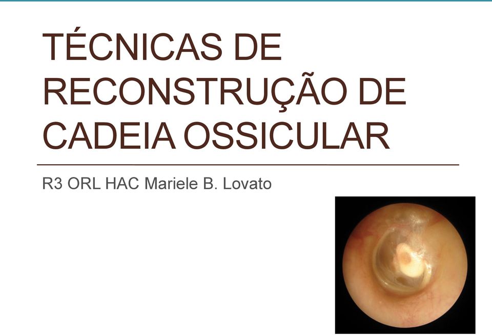 CADEIA OSSICULAR