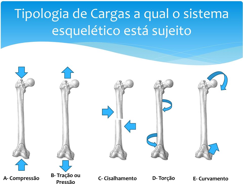 A- Compressão B- Tração ou