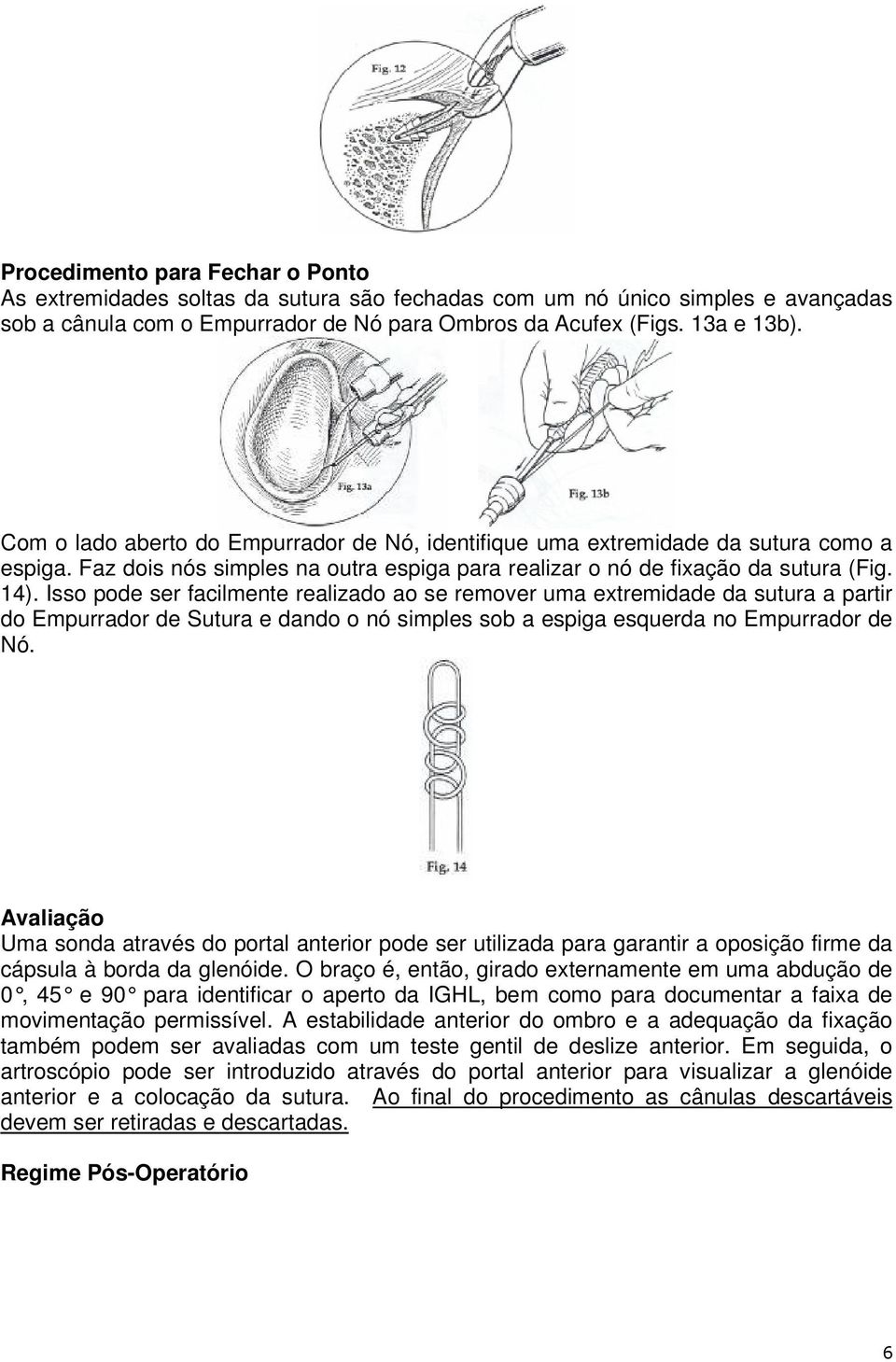 Isso pode ser facilmente realizado ao se remover uma extremidade da sutura a partir do Empurrador de Sutura e dando o nó simples sob a espiga esquerda no Empurrador de Nó.