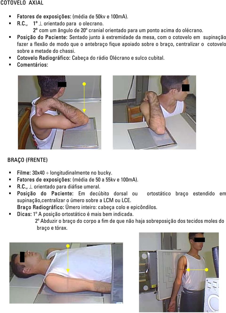 chassi. Cotovelo Radiográfico: Cabeça do rádio Olécrano e sulco cubital. Comentários: BRAÇO (FRENTE) Filme: 30x40 longitudinalmente no bucky. Fatores de exposições: (média de 50 a 55kv e 100mA). R.C., orientado para diáfise umeral.