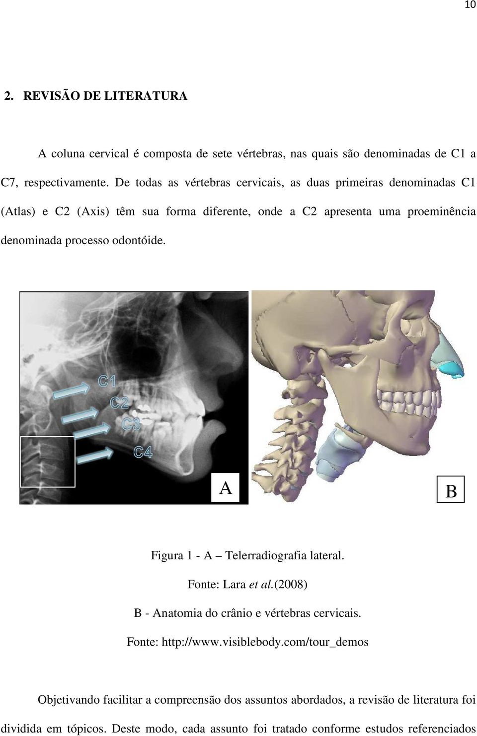 processo odontóide. A B Figura 1 - A Telerradiografia lateral. Fonte: Lara et al.(2008) B - Anatomia do crânio e vértebras cervicais. Fonte: http://www.