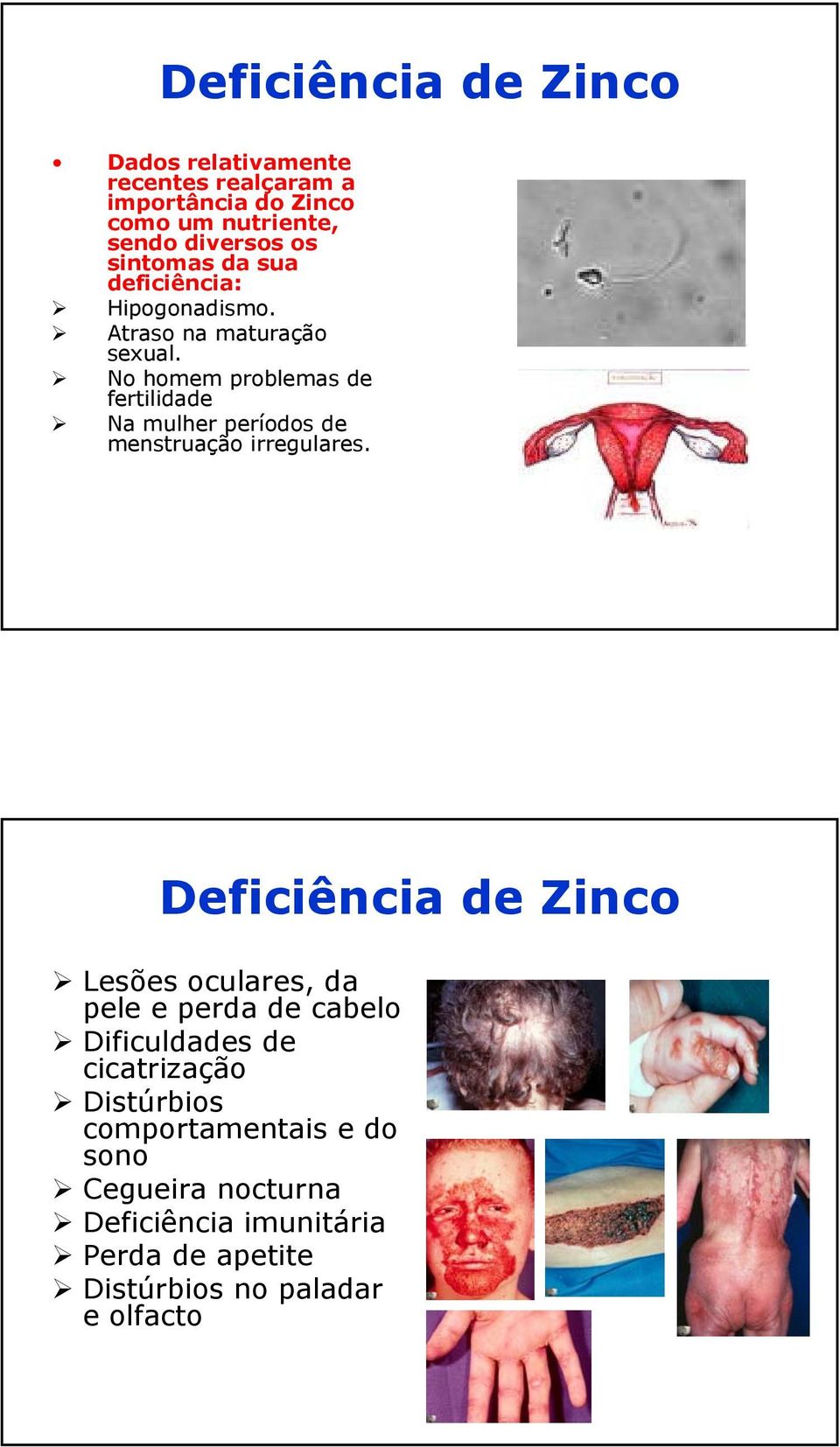 No homem problemas de fertilidade Na mulher períodos de menstruação irregulares.