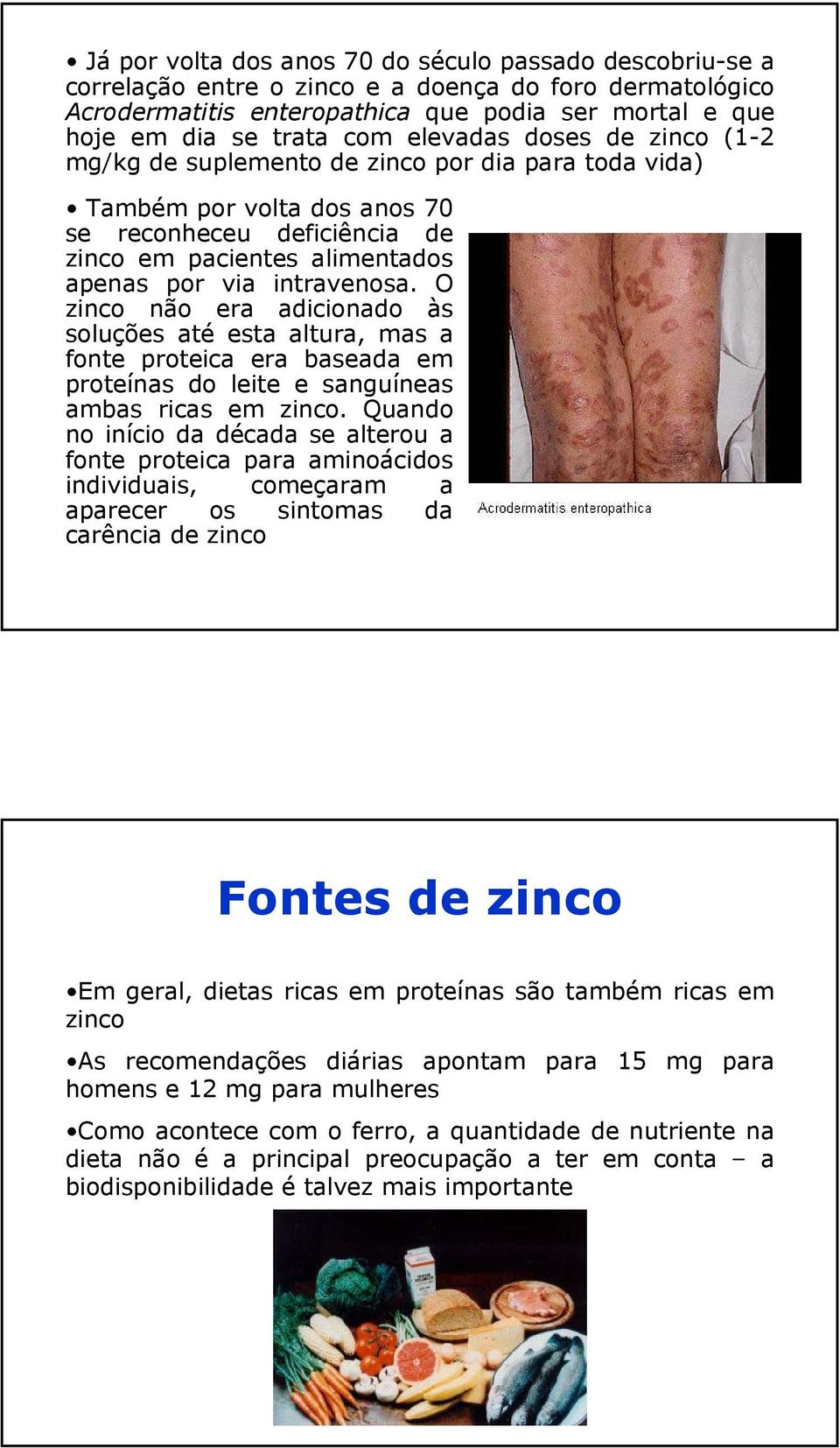 O zinco não era adicionado às soluções até esta altura, mas a fonte proteica era baseada em proteínas do leite e sanguíneas ambas ricas em zinco.