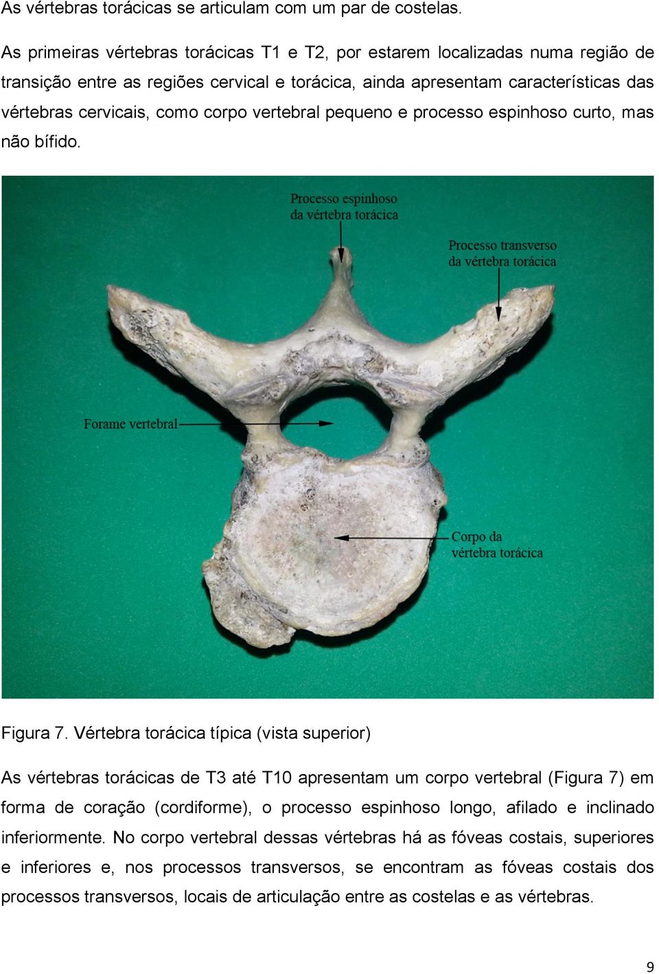 corpo vertebral pequeno e processo espinhoso curto, mas não bífido. Figura 7.