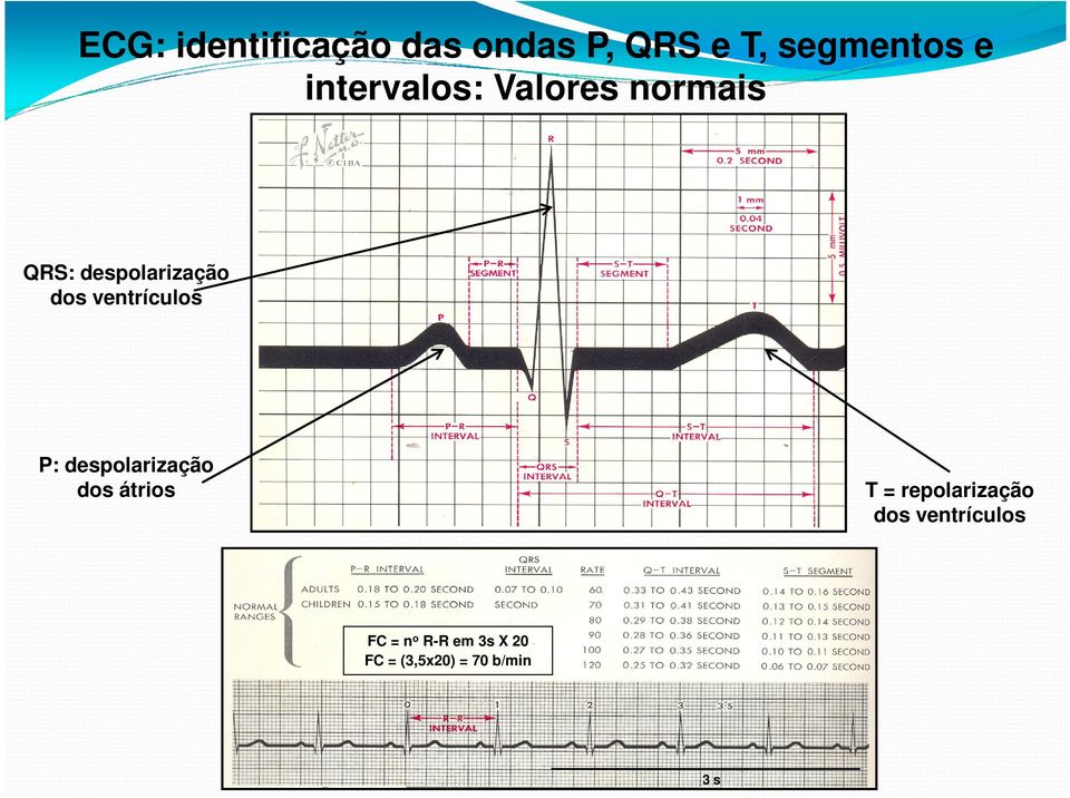ventrículos P: despolarização dos átrios T =
