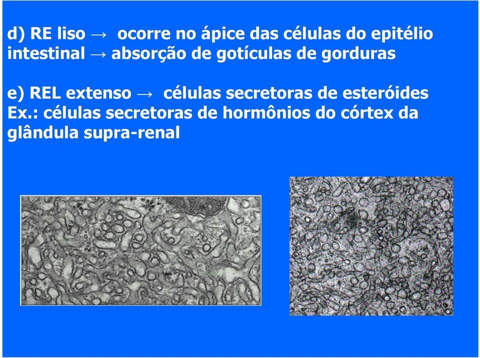 extenso células secretoras de esteróides Ex.