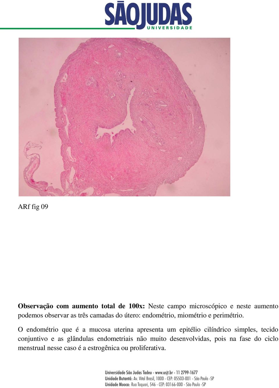 O endométrio que é a mucosa uterina apresenta um epitélio cilíndrico simples, tecido conjuntivo e