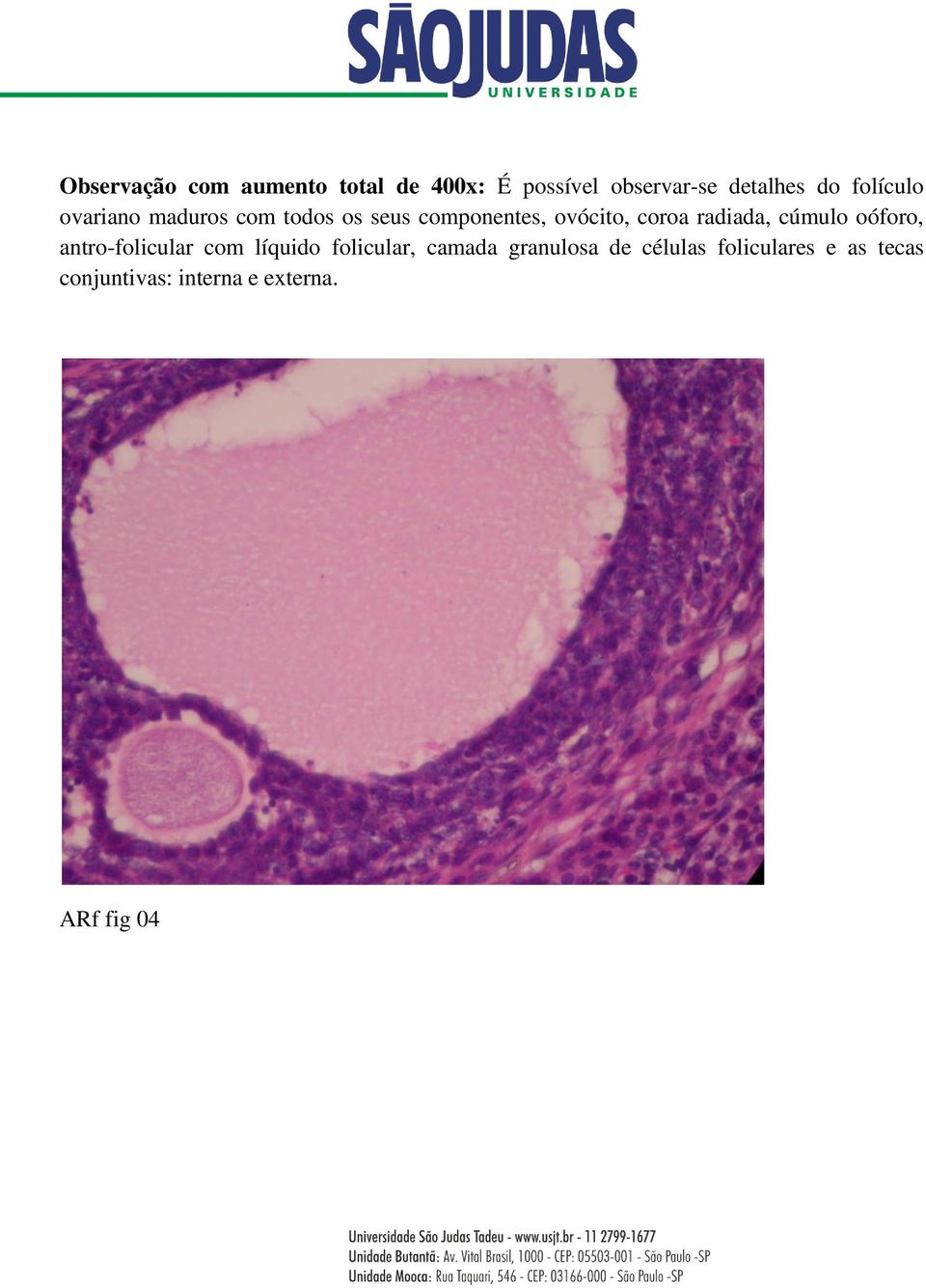 radiada, cúmulo oóforo, antro-folicular com líquido folicular, camada