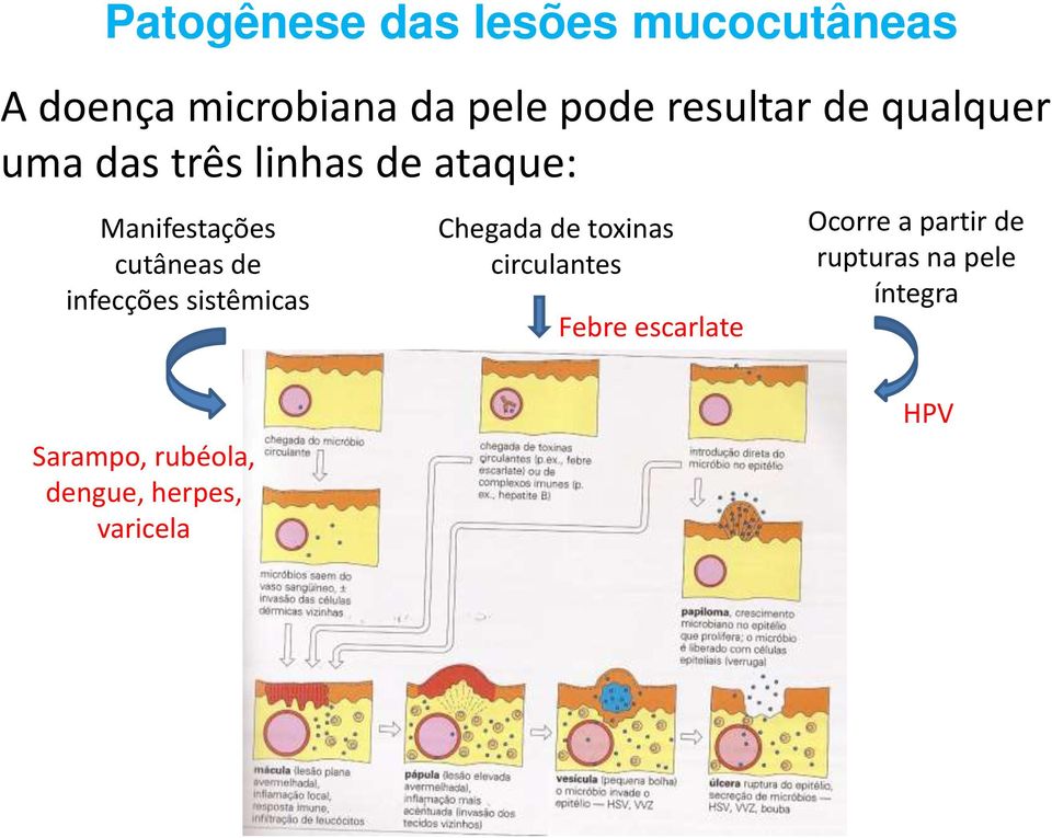 de infecções sistêmicas Chegada de toxinas circulantes Febre escarlate