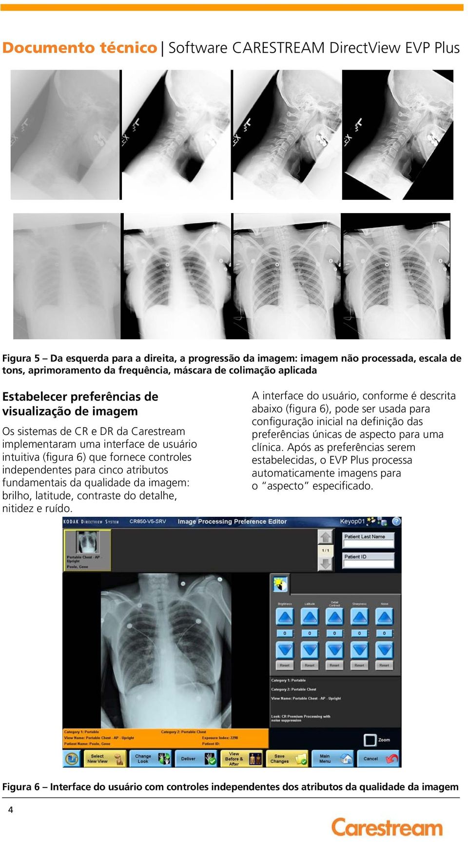 imagem: brilho, latitude, contraste do detalhe, nitidez e ruído.