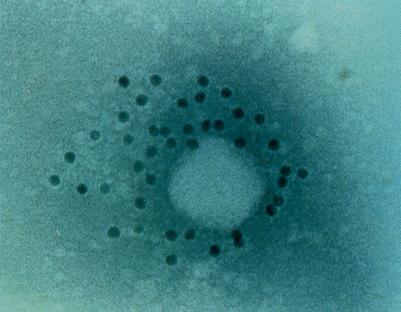 Visualização do Vírus C: 1993 O VHC é vírus RNA de hélice simples com polaridade positiva, envelope lipídico e diâmetro de 30-70 nm.