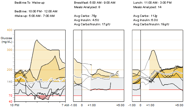 Sobreposição dos traçados de glicose do sensor Períodos nocturnos (do deitar ao acordar) e das refeições Leituras e médias Do deitar ao acordar Este gráfico combina os traçados de glicose do sensor