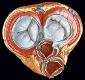 ventrículos contraem-se (sístole ventricular) e forçam o sangue para fora do coração.