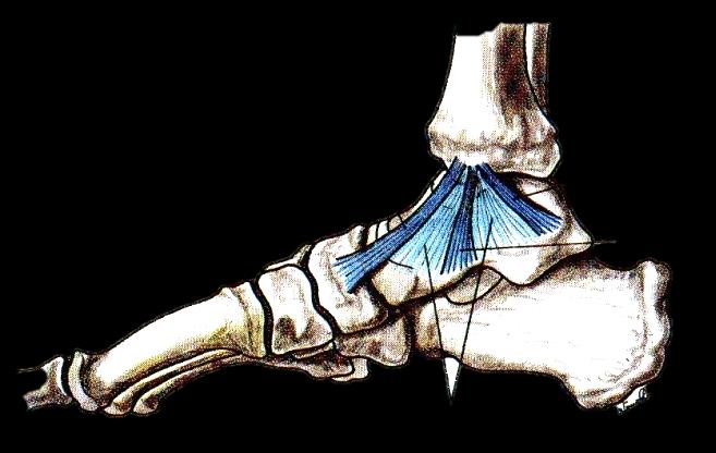 Ligamento lateral externo Este ligamento é constituído por três feixes independentes. O feixe anterior (ou ligamento talofibular anterior) (figura 13.