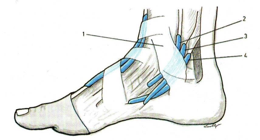Figura 27 Ligamento anular do tarso e bainha sinovial dos tendões da região interna do pé. [56] 1) Ligamento anular interno do tarso. 2) Bainha sinovial do tendão do músculo tibial posterior.