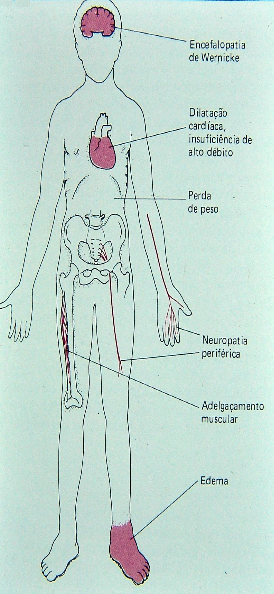 Deficiência de