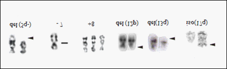 Maria Christina P. Maioli et al. Tabela 2. Classificação das SMD (OMS-2008) 2.