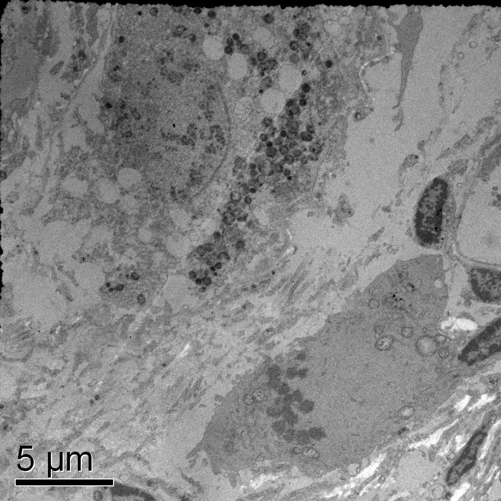 ng/ml LH (8000x); (C) or FSH plus 1 ng/ml LH (15000x) and (D) degenerated follicles after 7 days culture in medium