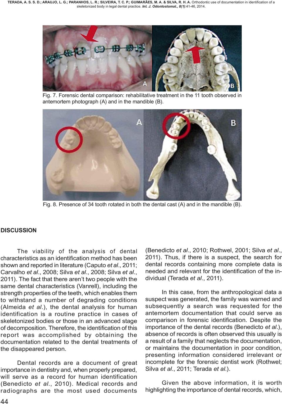 DISCUSSION The viability of the analysis of dental characteristics as an identification method has been shown and reported in literature (Caputo et al., 2011; Carvalho et al., 2008; Silva et al.