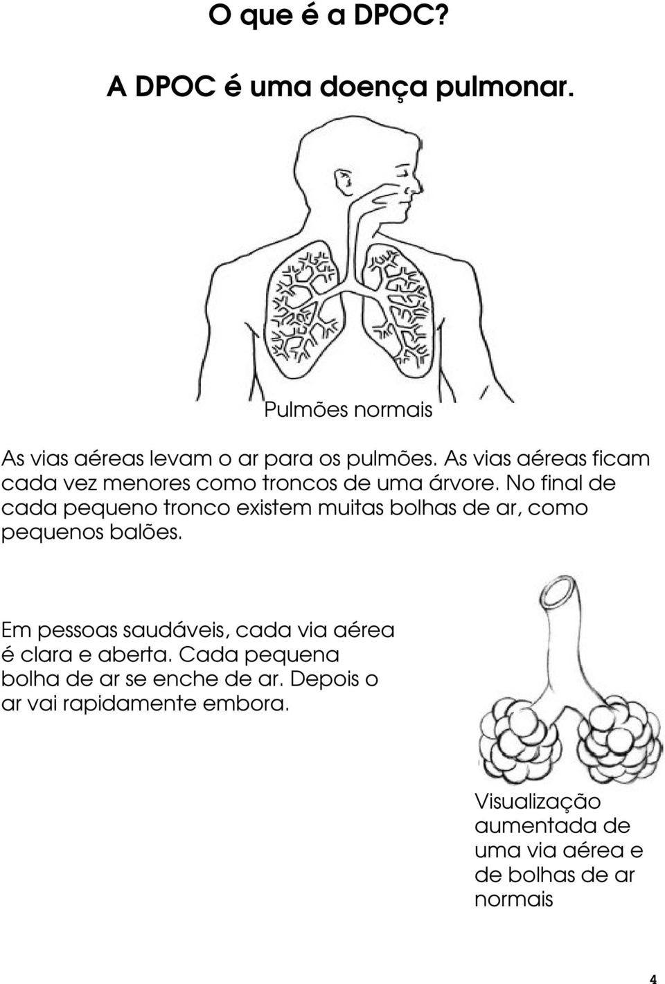 No final de cada pequeno tronco existem muitas bolhas de ar, como pequenos balões.