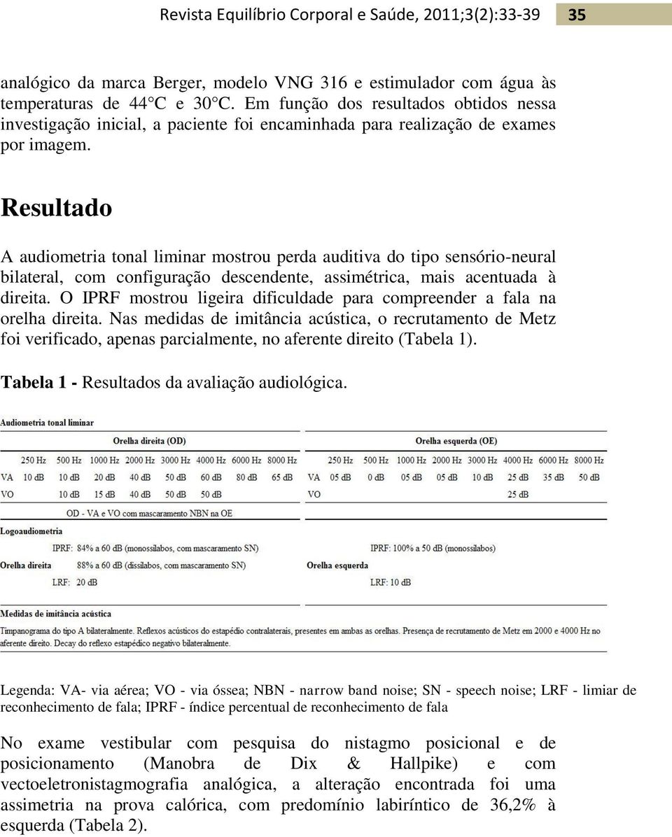 Resultado A audiometria tonal liminar mostrou perda auditiva do tipo sensório-neural bilateral, com configuração descendente, assimétrica, mais acentuada à direita.