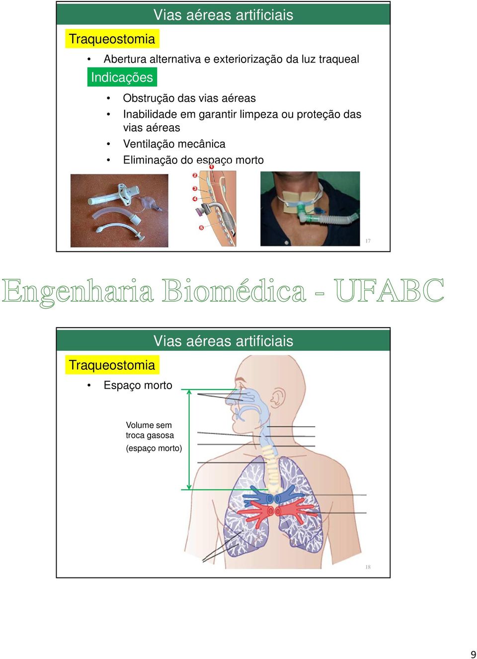 proteção das vias aéreas Ventilação mecânica Eliminação do espaço morto