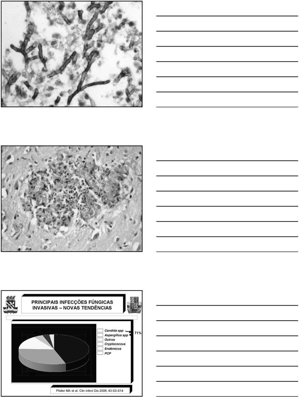 Aspergillus spp Outros Cryptococcus Endêmicos