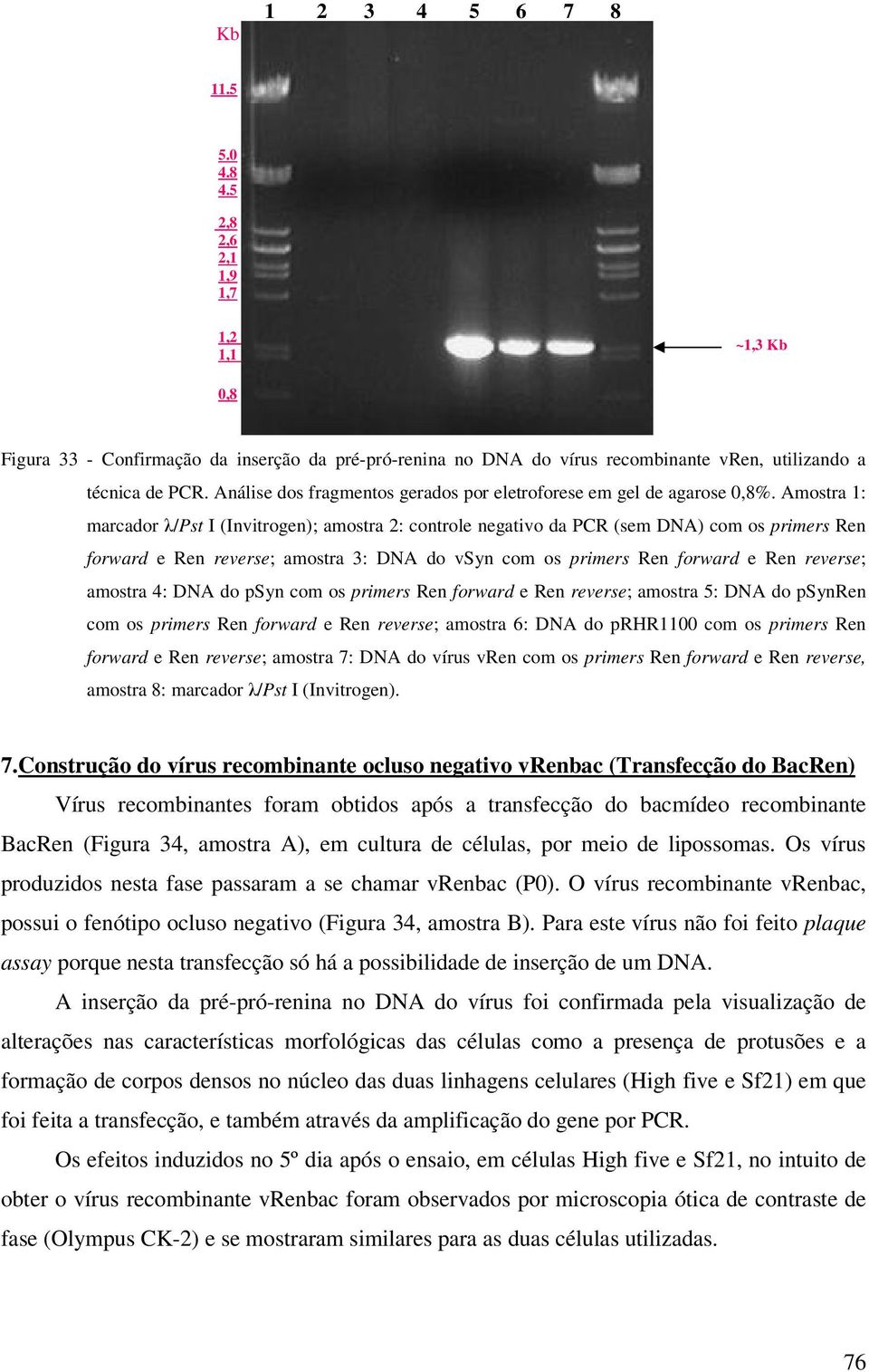 Amostra 1: marcador λ/pst I (Invitrogen); amostra 2: controle negativo da PCR (sem DNA) com os primers Ren forward e Ren reverse; amostra 3: DNA do vsyn com os primers Ren forward e Ren reverse;