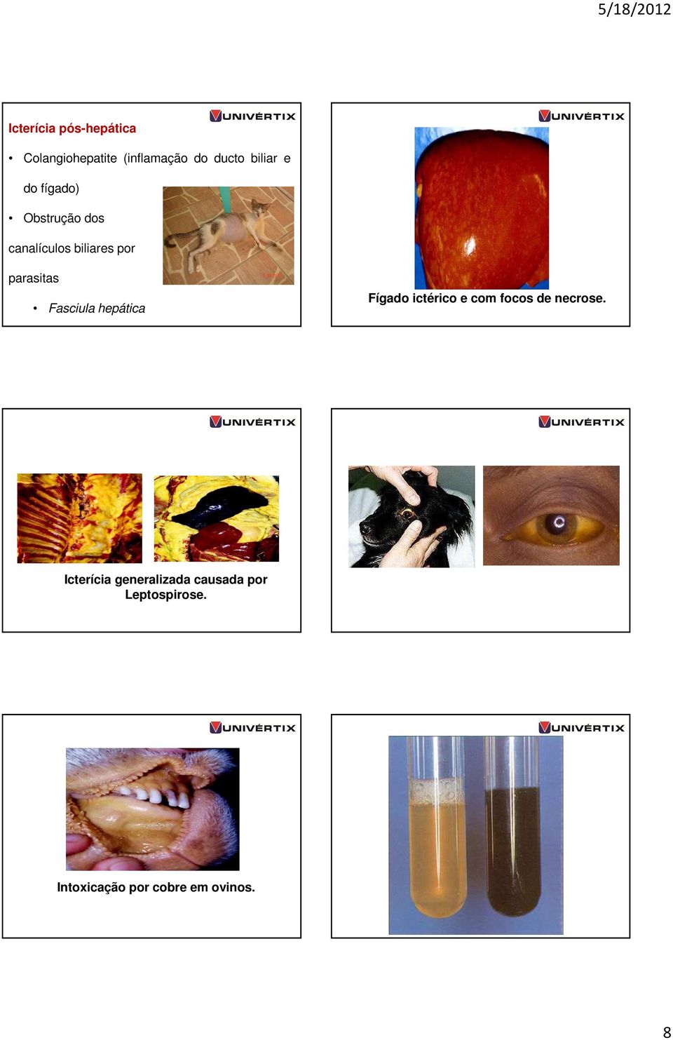 Fasciula hepática Fígado ictérico e com focos de necrose.