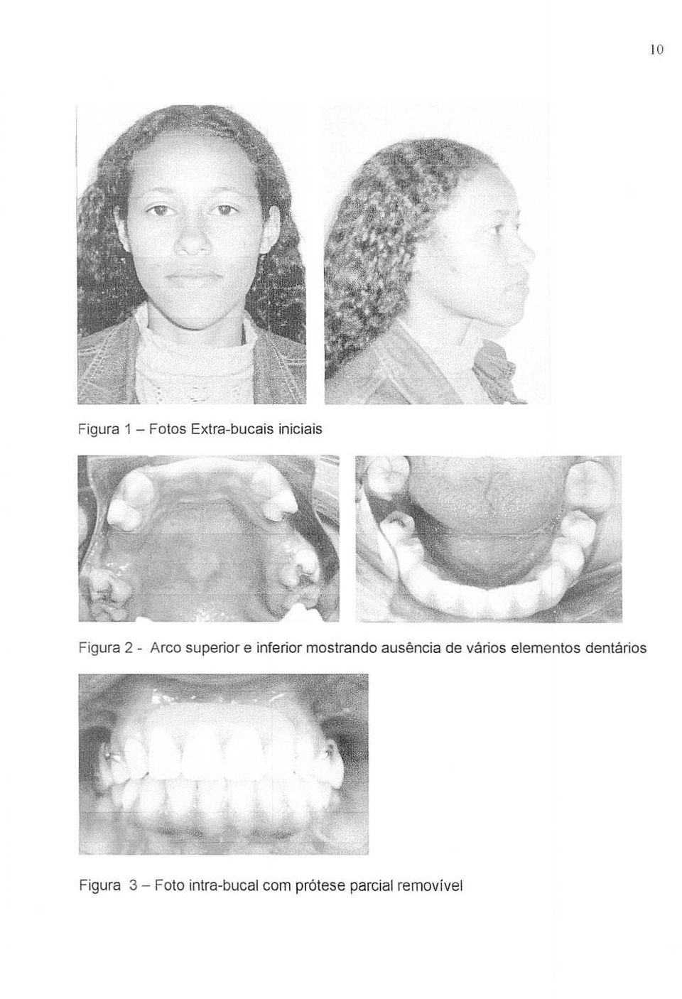 ausencia de varies elementos dentarios Figura