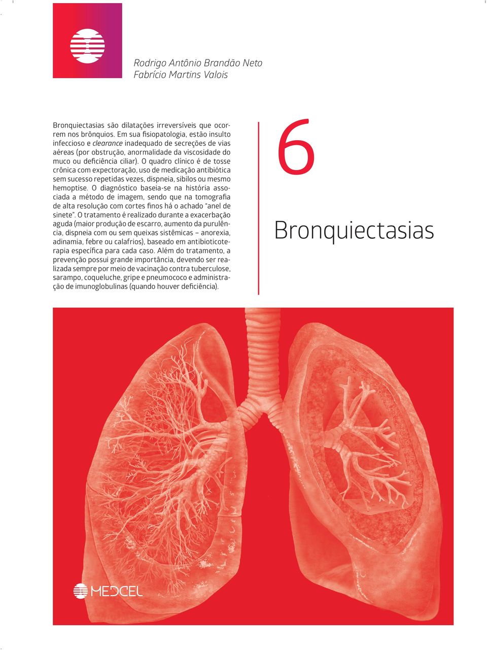 O quadro clínico é de tosse crônica com expectoração, uso de medicação antibiótica sem sucesso repetidas vezes, dispneia, sibilos ou mesmo hemoptise.